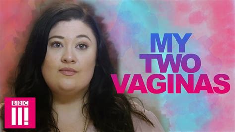 frau 2 vaginas|Living Differently: The Woman With Two Vaginas